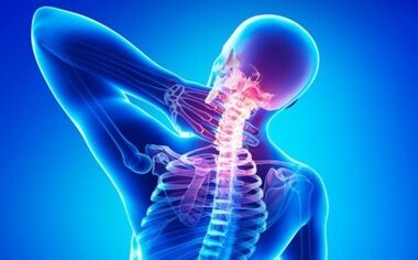 uszkodzenie kręgosłupa z osteochondrozą szyjną