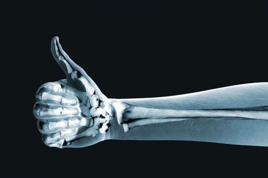 Rentgen może pomóc w zdiagnozowaniu bólu stawów palców