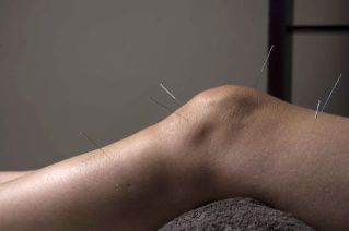 Akupunktura wspomaga naprawę tkanki stawowej
